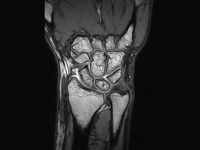 Image clinique Magnifico du poignet en 3D SHARC coronal